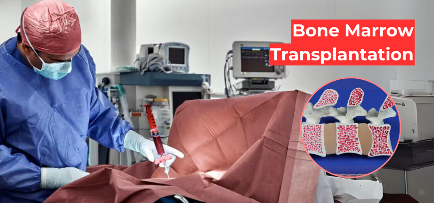 Bone Marrow Transplant in Kukatpally