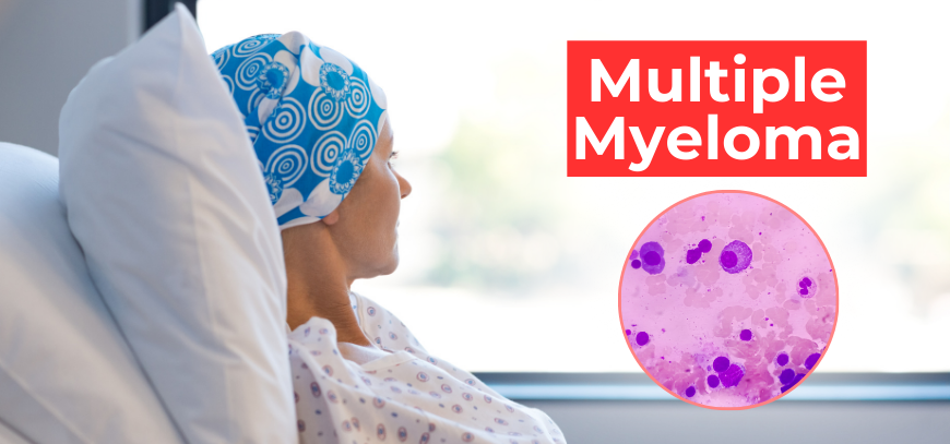 Multiple Myeloma Treatment in Kukatpally